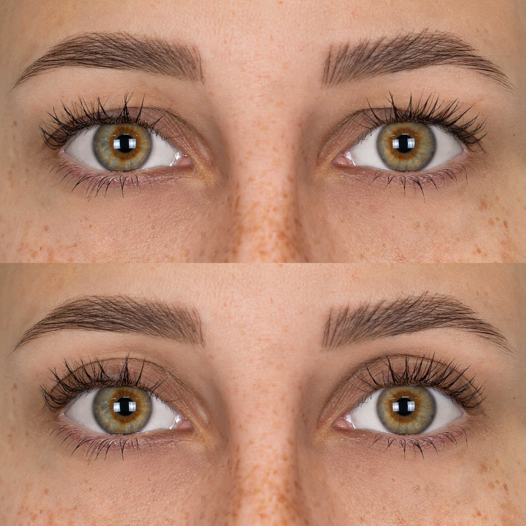 Patchs Lift Paupières