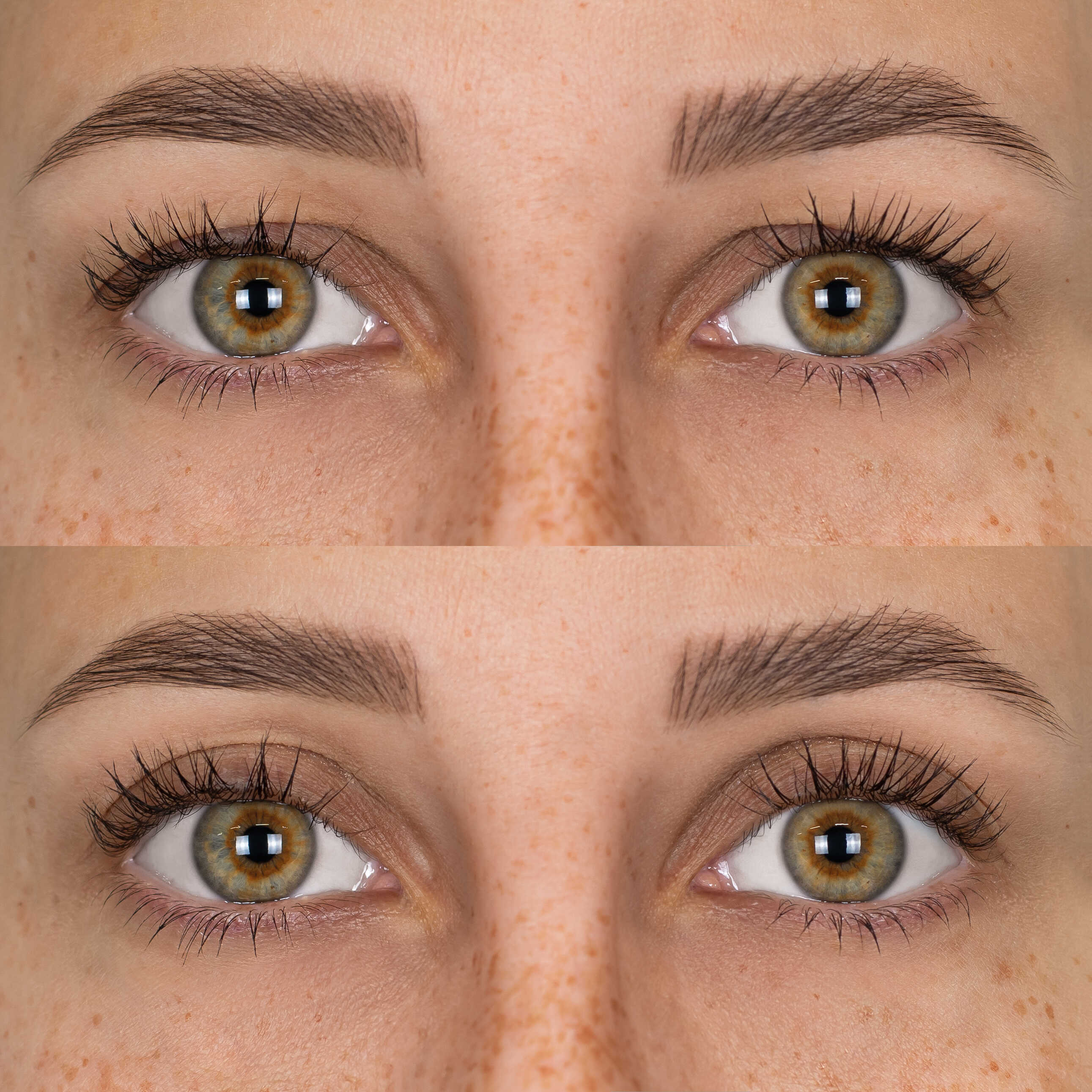 Patchs Lift Paupières